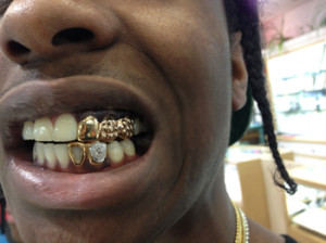 Do you think Gold Grills/Teeth are attractive ?