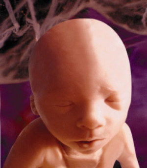 Abortion Provider: John Biskind