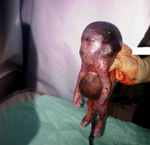Half-human half-goat baby; Baby with human head and goat legs