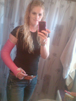 Pink Arm Cast
