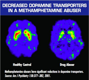 Real Diseases versus The Disease Concept or Theory of Drug Addiction