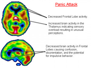 panic panicchick brain