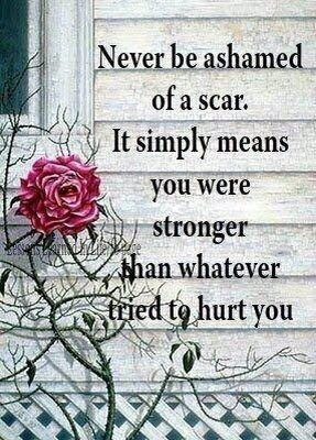 Exactly...I call mine battle scars...I'm proud of mine!!!...kd