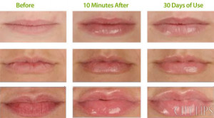 before and after images from City Lips users who acheived fuller lips