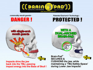 Securing and cushioning the unprotected Jaw is Key to TMJ & Base of ...