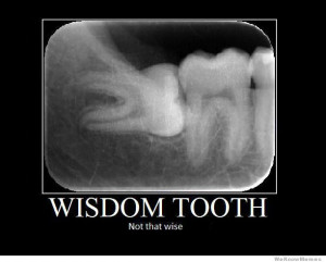 Wisdom tooth – not that wise