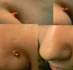 ... than a bleeding pimple under nose stud or am I just a worry wart