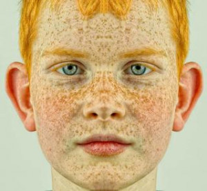 Gingerism and Bullying