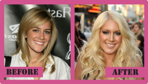 Heidi Montag Before Plastic Surgery