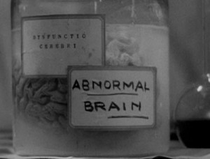 The Normal Brain and the Abnormal Brain in Frankenstein (1931) (film ...