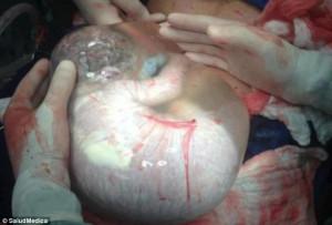 The baby that didn't know it had been born: Astonishing picture shows ...