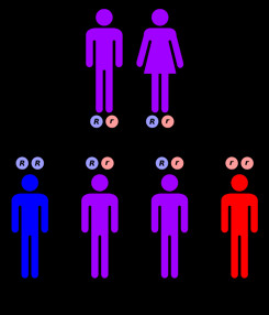 The genetics of Oculocutaeneous Albinism (OCA)