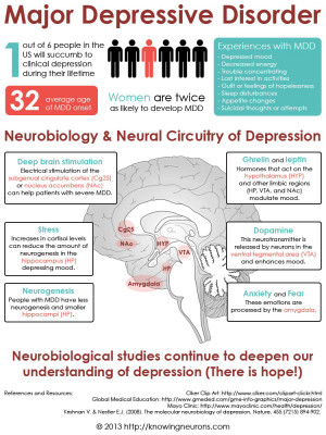 Major depressive disorder. #infographic #depression #neuroscience # ...