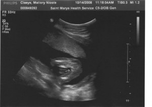 ultrasound pic of girls