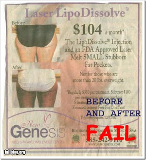 ... Injection and an FDA Approved Laser Melt Small Stubborn Fat Pockets