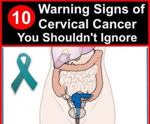 10 Warning Signs of Cervical Cancer You Shouldn’t Ignore