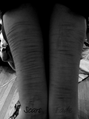 Scars Fade by kml91225