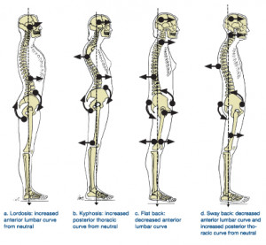 bad-posture-spine.jpg