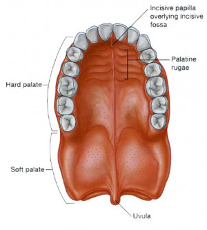 CLEFT PALATE &CLEFT LIP