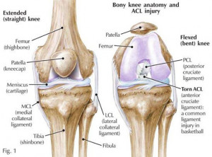 figure 5 knee anatomy normal and with acl tear