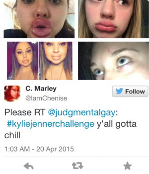 We gave the #KylieJennerChallenge hashtag a quick search on Instagram ...