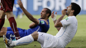 PHOTO: Uruguays Luis Suarez holds his teeth after running into Italys ...