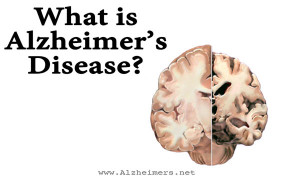 what-is-alzheimers-disease.jpg