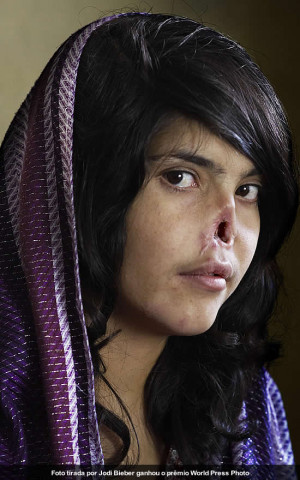 Imagem de afegã desfigurada ganha prêmio de fotografia