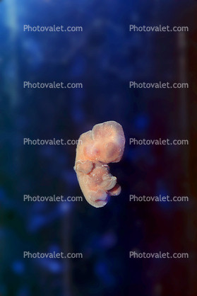Fetus at 6 Weeks Embryo