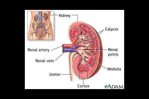 renal kidney failure