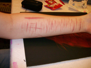 Cutting Scars Scars don't heal when you keep