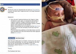 Facebook Says No, Then Yes, To Father Seeking Heart Transplant For Son