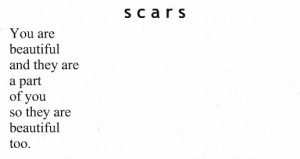 1551 notes tags scars beautiful sad sad quotes hurt alone depressed ...