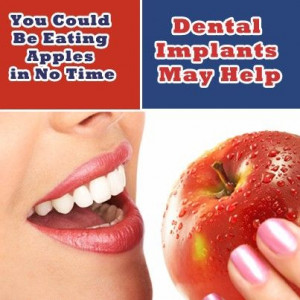 Dental Implants - Dental Implants Las Vegas - Call (702) 830-4888 or ...