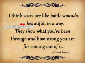think scars are like battle wounds – beautiful, in a way. They ...