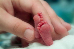 Um recém-nascido (prematuro, a termo ou pósmaturo) que é menor que ...