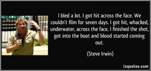 bled a lot. I got hit across the face. We couldn't film for seven ...