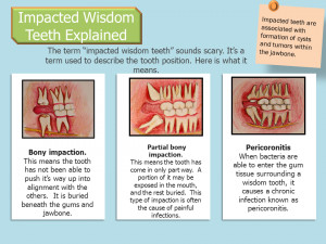 Impacted and erupted wisdom teeth
