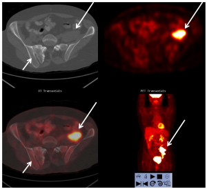 Sad Quotes About Losing