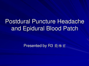 Epidural Blood Patch headache by mikeholy