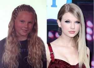 Taylor Swift, Before and After Plastic Surgery