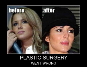 Plastic surgery went wrong.