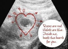 Here are some #pregnancy announcements and poems for you to try when ...