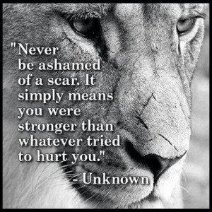 have so many scars, and I'm trying to learn to embrace them. This ...