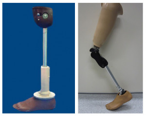 Prosthesis:Low cost artificial leg