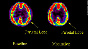 Your Brain on Yoga: New Studies in Neuroscience Show Meditation ...