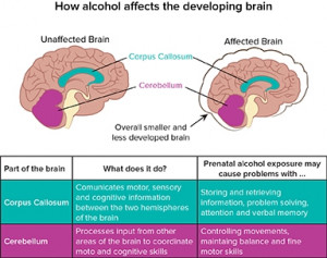 how_alcohol_affects_the_developing_brain.jpg