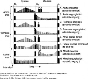 Search Results for: Heart Murmur Diagram