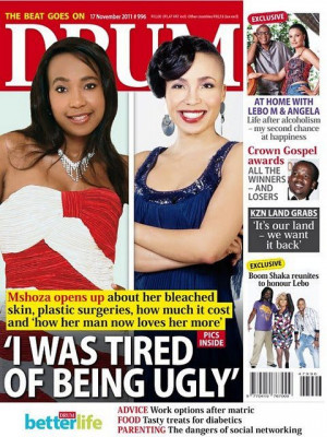 mshoza who is obsessed with skin lightening practice and plastic ...