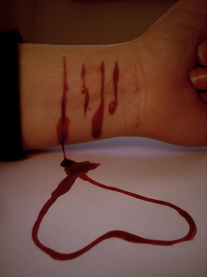 ... cutting himself to deal with his depression he cut my initials into